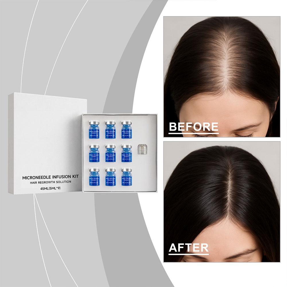 Set de Rodillo de Microagujas  - Hair Care Oil Serum reseña y precio